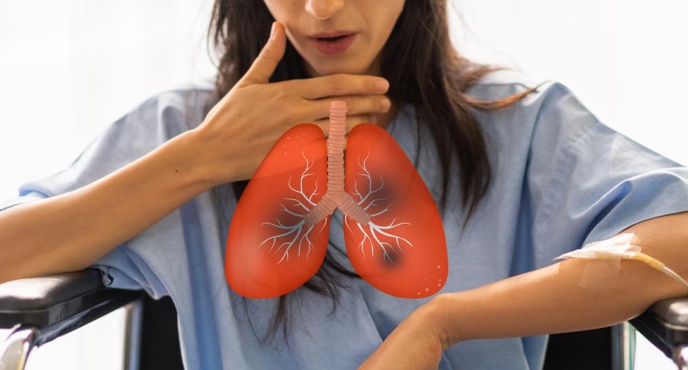 Inquinamento dell’aria e vie respiratorie: quali sono gli effetti?