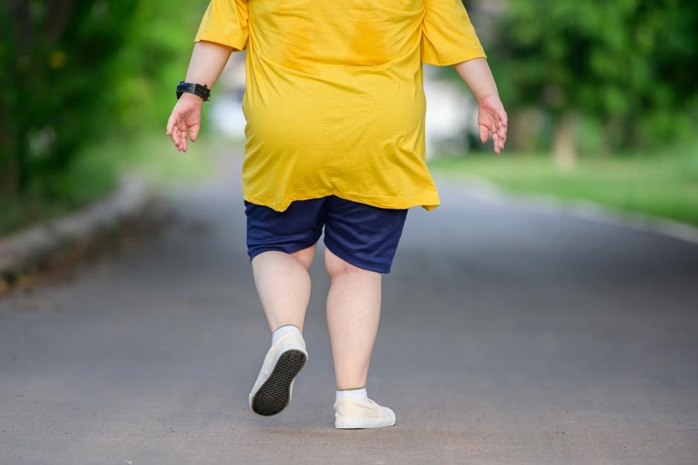 UNICEF: obesità infantile supera la malnutrizione globale