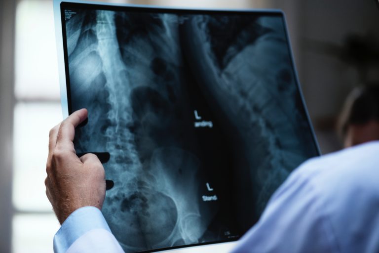 Diagnosi incompleta, la Cassazione: «Medico colpevole di lesioni personali»