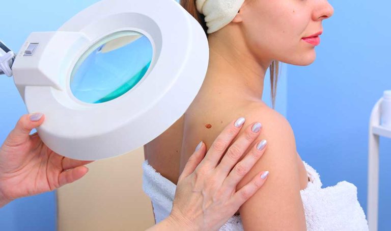 Tumori della pelle: crescono i casi, più prevenzione sui carcinomi “minori”