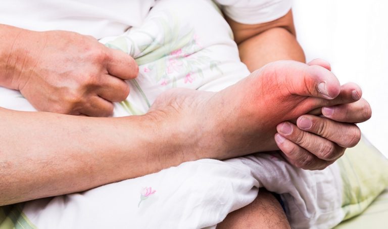 Artrite reumatoide: il ruolo del podologo nell’équipe di cura multidisciplinare